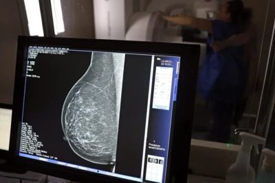 1773 saude mental da crianca entrevista horizontal