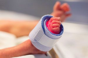 1395 bebes que nascem prematuros pé de bebe na incubadora url