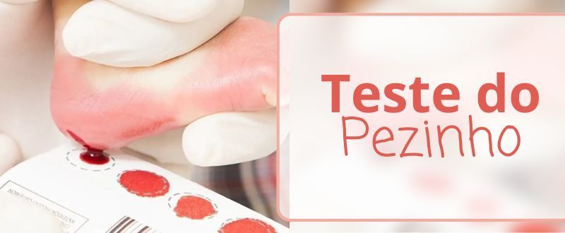 1762 testedopezinho banner
