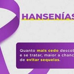 Quanto mais cedo as pessoas com Hanseníase forem tratadas, menor é a chance de transmissão